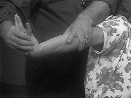 Tennis Elbow Treatment - Mills Manipulation